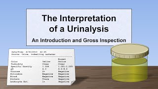 Interpretation of the Urinalysis Part 1  Introduction and Inspection [upl. by Inacana427]