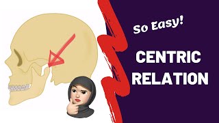 Centric Relation  The Dilemma [upl. by Nallad]